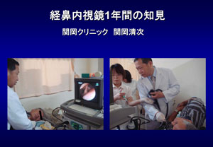 経鼻内視鏡