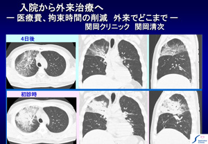 講演”入院から外来治療へ”