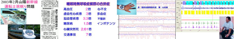 睡眠時無呼吸症候群画像