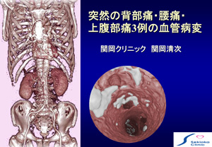 志摩臨床研究会講演　血管病変